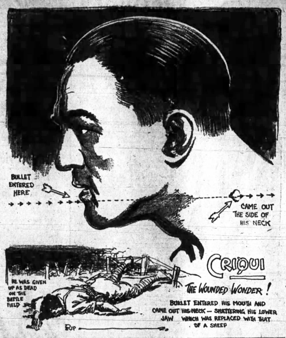 Illustration of Gene Criqui's bullet wound